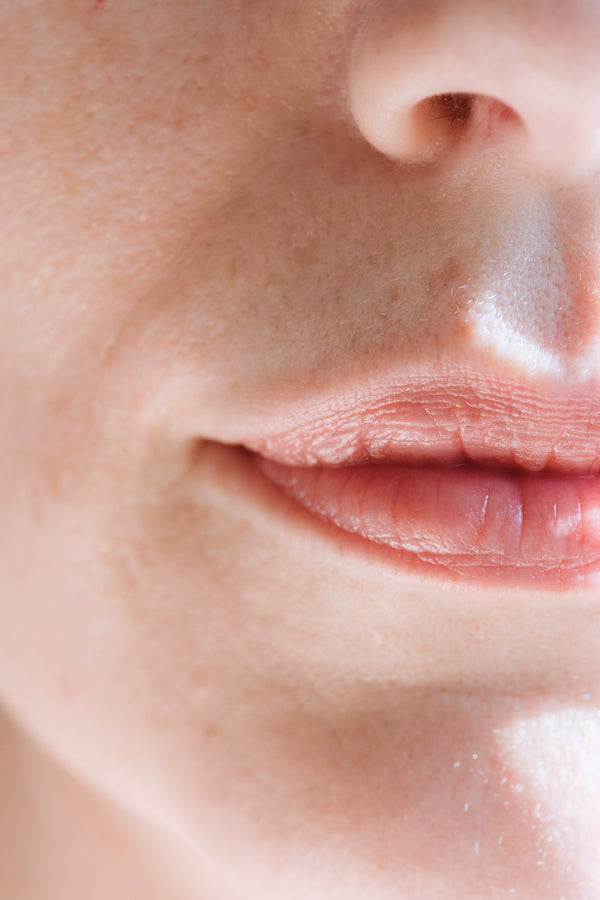 5 ways you can protect your skin during this cold season